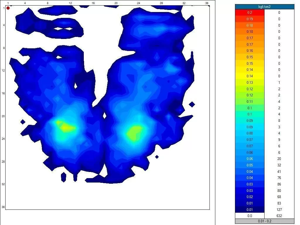Putnam Bariatric Cushion 8 Putnam Bariatric Cushion - Image 6