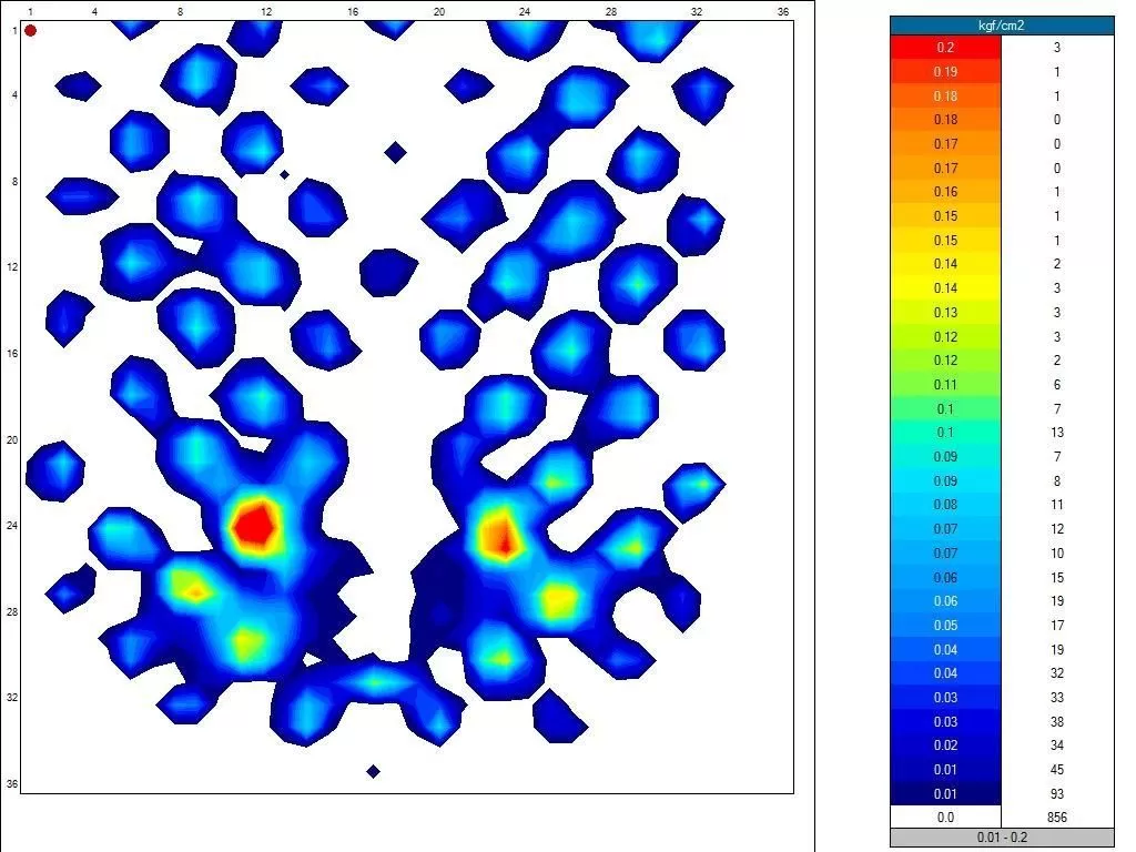 Sero Pressure Cushion Dr Huff Cut Out 18 Sero Pressure Cushion Dr Huff Cut Out - Image 16